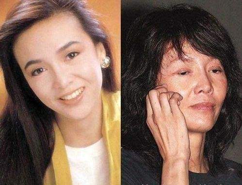 娱乐圈整容女明星名单_孙菲菲整容后无戏可拍_娱乐圈没整过容的明星