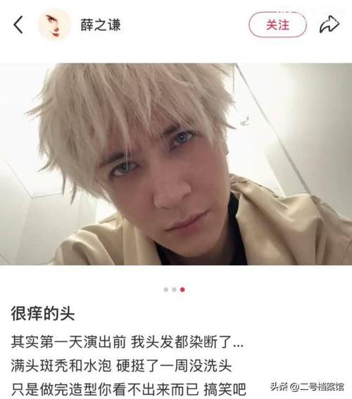 娱乐圈脱发大军添新人，薛之谦徐志胜全都秃了